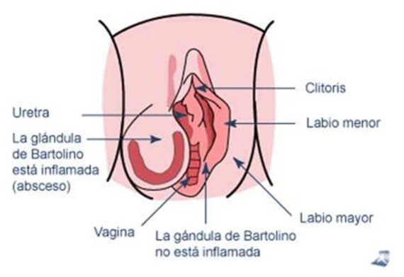 infecciones-vulvovaginales-1